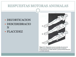 RESPUESTAS MOTORAS ANOMALAS


 DECORTICACION
 DESCEREBRACIO
  N
 FLACCIDEZ
 