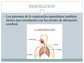 RESPIRACION

 Los patrones de la respiración espontánea también
 tienen una correlación con los niveles de afectación
 cerebral.
 