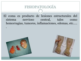 FISIOPATOLOGÍA

El coma es producto de lesiones estructurales del
  sistema    nervioso      central,    tales   como
  hemorragias, tumores, inflamaciones, edemas, etc.….
  .
 