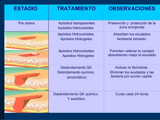 Cuidados De Enfermeria En Upp