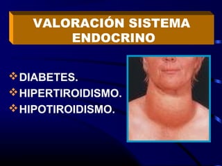 DIABETES.
HIPERTIROIDISMO.
HIPOTIROIDISMO.
VALORACIÓN SISTEMA
ENDOCRINO
 
