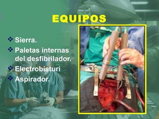 EQUIPOS
 Sierra.
 Paletas internas
del desfibrilador.
 Electrobísturi
 Aspirador.
 