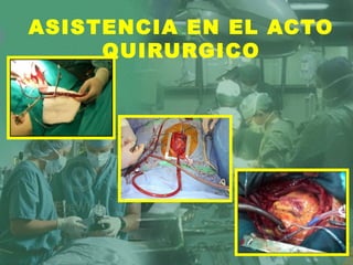 ASISTENCIA EN EL ACTO
QUIRURGICO
 