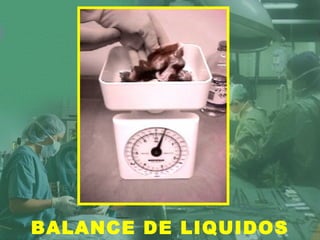 BALANCE DE LIQUIDOS
 