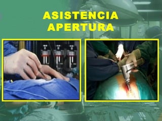 ASISTENCIA
 APERTURA
 