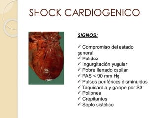 SHOCK CARDIOGENICO
SIGNOS:
 Compromiso del estado
general
 Palidez
 Ingurgitación yugular
 Pobre llenado capilar
 PAS < 90 mm Hg
 Pulsos periféricos disminuidos
 Taquicardia y galope por S3
 Polipnea
 Crepitantes
 Soplo sistólico
 
