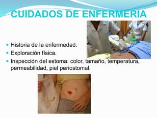 CUIDADOS DE ENFERMERIA
 Historia de la enfermedad.
 Exploración física.
 Inspección del estoma: color, tamaño, temperatura,
permeabilidad, piel periostomal.
 