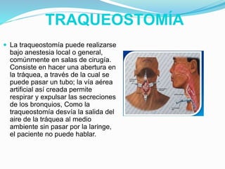 TRAQUEOSTOMÍA
 La traqueostomía puede realizarse
bajo anestesia local o general,
comúnmente en salas de cirugía.
Consiste en hacer una abertura en
la tráquea, a través de la cual se
puede pasar un tubo; la vía aérea
artificial así creada permite
respirar y expulsar las secreciones
de los bronquios, Como la
traqueostomía desvía la salida del
aire de la tráquea al medio
ambiente sin pasar por la laringe,
el paciente no puede hablar.
 