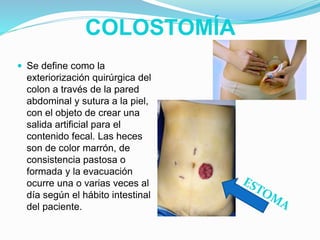 COLOSTOMÍA
 Se define como la
exteriorización quirúrgica del
colon a través de la pared
abdominal y sutura a la piel,
con el objeto de crear una
salida artificial para el
contenido fecal. Las heces
son de color marrón, de
consistencia pastosa o
formada y la evacuación
ocurre una o varias veces al
día según el hábito intestinal
del paciente.
 