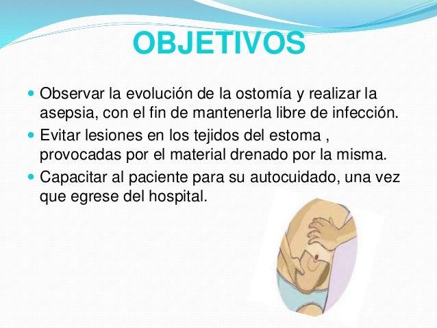 OSTOMIA Y TRAQUEOSTOMIA