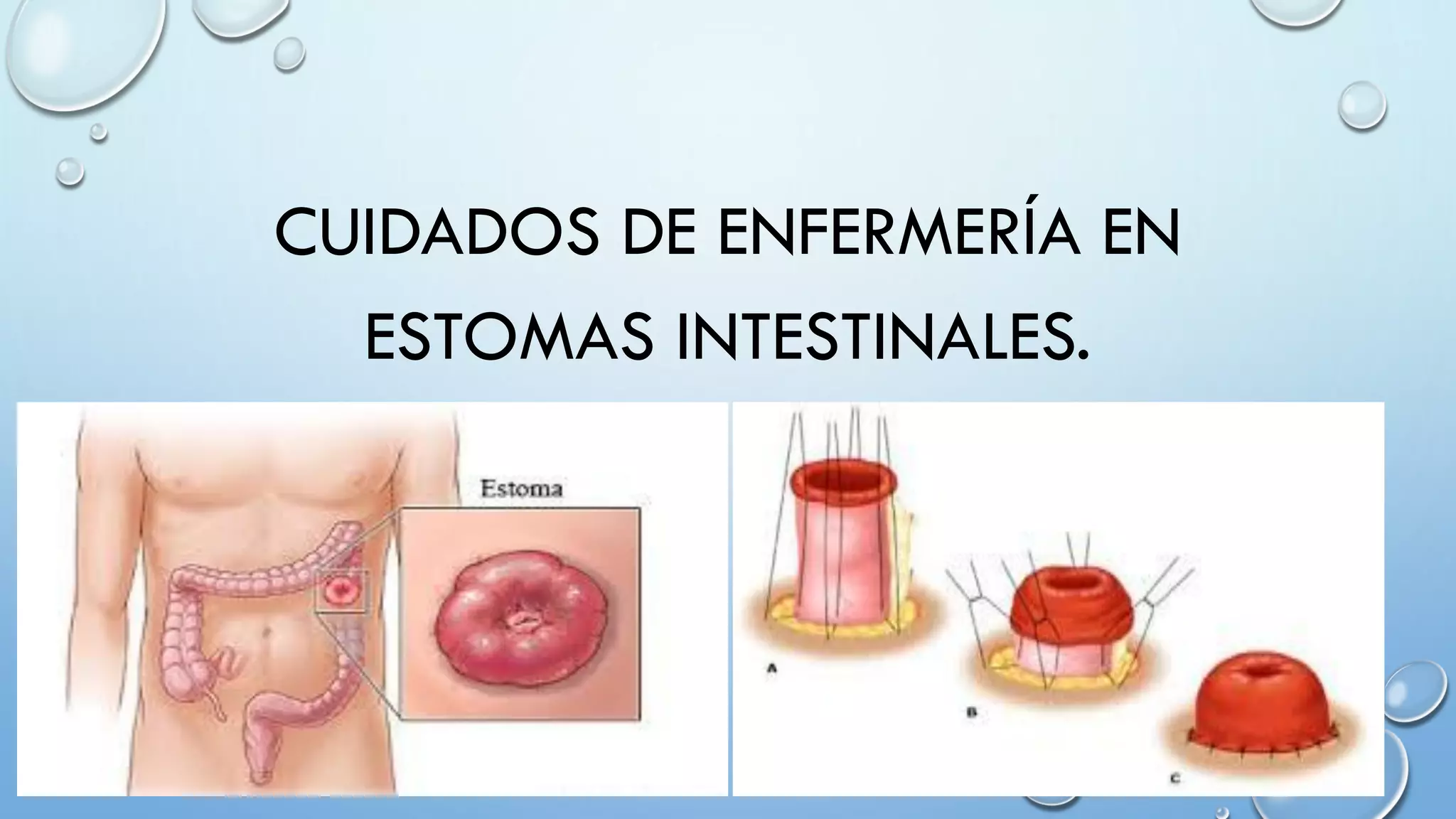 cuidados-de-estomas-ppt