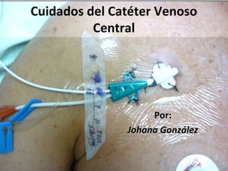 Cuidados del Catéter Venoso
          Central




                    Por:
               Johana González
 