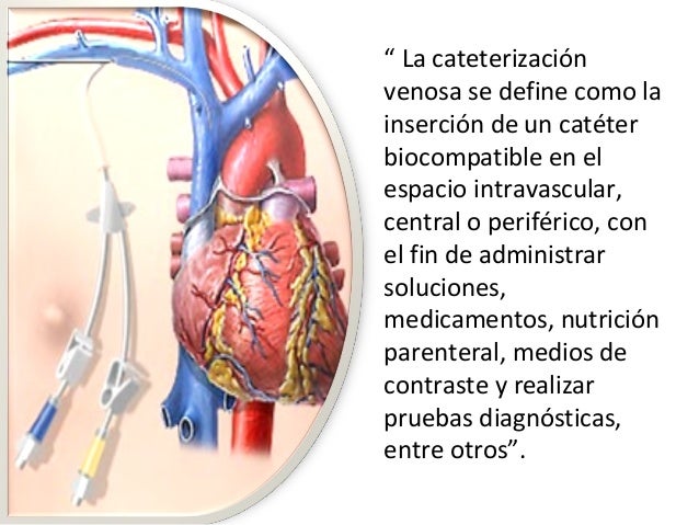 Resultado de imagen para cateter venoso central