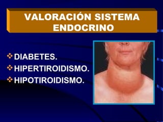 DIABETES.
HIPERTIROIDISMO.
HIPOTIROIDISMO.
VALORACIÓN SISTEMA
ENDOCRINO
 