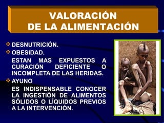 DESNUTRICIÓN.
OBESIDAD.
ESTAN MAS EXPUESTOS A
CURACIÓN DEFICIENTE O
INCOMPLETA DE LAS HERIDAS.
AYUNO
ES INDISPENSABLE CONOCER
LA INGESTIÓN DE ALIMENTOS
SÓLIDOS O LÍQUIDOS PREVIOS
A LA INTERVENCIÓN.
VALORACIÓN
DE LA ALIMENTACIÓN
 