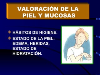  HÁBITOS DE HIGIENE.
 ESTADO DE LA PIEL:
EDEMA, HERIDAS,
ESTADO DE
HIDRATACIÓN.
VALORACIÓN DE LA
PIEL Y MUCOSAS
 