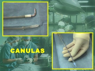 CANULAS
 