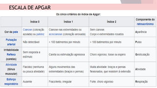 ESCALA DE APGAR
 