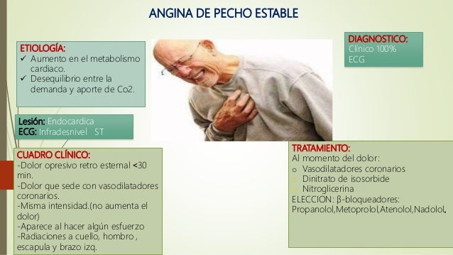 Cuidados intensivos para la angina de pecho