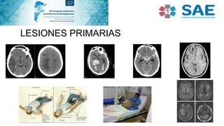 LESIONES PRIMARIAS
 
