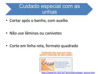 Cuidado especial com as
unhas
• Cortar após o banho, com auxílio
• Não use lâminas ou canivetes
• Corte em linha reta, formato quadrado
http://www.hu.ufsc.br/~grumad/cuidado_basico.htm
 