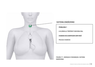 SISTEMA ENDÓCRINO

                         PROBLEMA 1


                         A GLÂNDULA TIREÓIDE FUNCIONA MAL


                         CHANCES DE ACONTECER COM VOCÊ


                         POUCAS CHANCES




                      FIGURA 17 - DOENÇAS E MUDANÇAS: SISTEMA
                      ENDÓCRINO


Ministério da Saúde                     CUIDADOS DE SAÚDE ÀS PESSOAS COM SÍNDROME DE DOWN
                                                                                            19
 