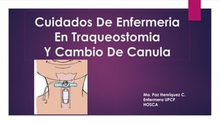 Cuidados De Enfermeria
En Traqueostomia
Y Cambio De Canula
Ma. Paz Henríquez C.
Enfermera UPCP
HOSCA
 