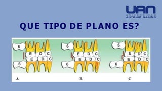 QUE TIPO DE PLANO ES?
 