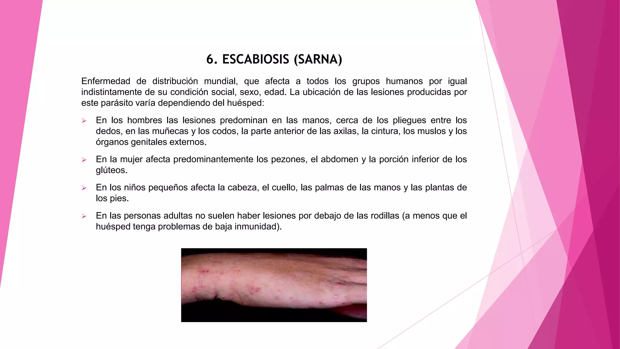 6. ESCABIOSIS (SARNA)
Enfermedad de distribución mundial, que afecta a todos los grupos humanos por igual
indistintamente de su condición social, sexo, edad. La ubicación de las lesiones producidas por
este parásito varía dependiendo del huésped:
 En los hombres las lesiones predominan en las manos, cerca de los pliegues entre los
dedos, en las muñecas y los codos, la parte anterior de las axilas, la cintura, los muslos y los
órganos genitales externos.
 En la mujer afecta predominantemente los pezones, el abdomen y la porción inferior de los
glúteos.
 En los niños pequeños afecta la cabeza, el cuello, las palmas de las manos y las plantas de
los pies.
 En las personas adultas no suelen haber lesiones por debajo de las rodillas (a menos que el
huésped tenga problemas de baja inmunidad).
 