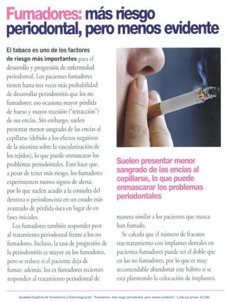 Sociedad Española de Periodoncia y Osteointegración. “Fumadores: más riesgo periodontal, pero menos evidente”. Cuida tus encías 02 (08)
 