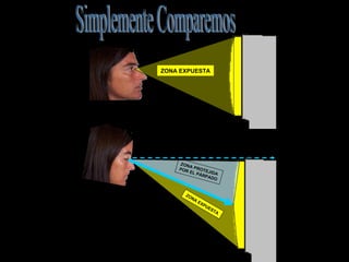 ZONA PROTEJIDA POR EL PÁRPADO ZONA EXPUESTA ZONA EXPUESTA Simplemente Comparemos 
