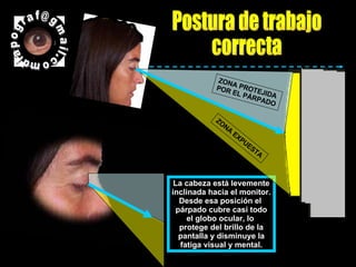 La cabeza está levemente inclinada hacia el monitor. Desde esa posición el  párpado cubre casi todo el globo ocular, lo  protege del brillo de la pantalla y disminuye la fatiga visual y mental. Postura de trabajo correcta ZONA PROTEJIDA POR EL PÁRPADO ZONA EXPUESTA diapograf@gmail.com  