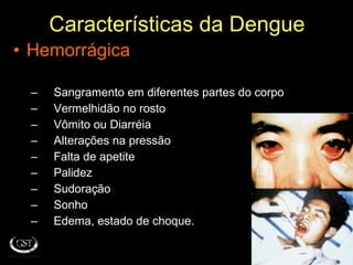 Características da Dengue Hemorrágica Sangramento em diferentes partes do corpo Vermelhidão no rosto Vômito ou Diarréia Alterações na pressão Falta de apetite Palidez  Sudoração Sonho Edema, estado de choque. 