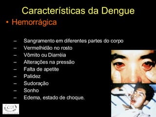 Características da Dengue Hemorrágica Sangramento em diferentes partes do corpo Vermelhidão no rosto Vômito ou Diarréia Alterações na pressão Falta de apetite Palidez  Sudoração Sonho Edema, estado de choque. 