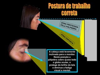 ZON
               A
           PEL PROTE
              A PÁ     G
                   LPE IDA
                      BRA

           ZO
              N   A
                      EX
                         PO
                            ST
                              A



 A cabeça está levemente
 inclinada para o monitor.
      Nesta posição a
pálpebra cobre quase todo
     o globo ocular, o
 protege do brilho da tela
     e diminue a fadiga
       visual e mental.
 