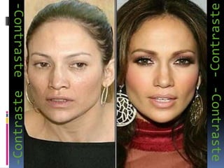 -Contraste-Contraste-Contraste-Contraste