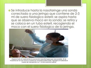  Se introduce hasta la nasofaringe una sonda
conectada a una jeringa que contiene de 2-3
ml de suero fisiologico esteril; se aspira hasta
que se observa moco en la sonda; se retira y
se coloca en un tubo esteril, recogiendo el
moco con el suero fisiologico de la jeringa.
 