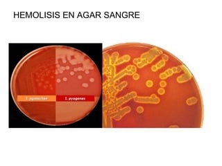 HEMOLISIS EN AGAR SANGRE
 