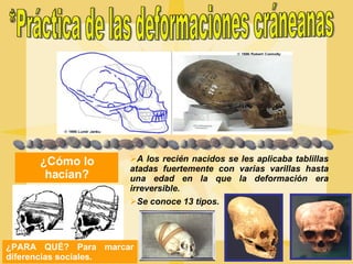 *Práctica de las deformaciones cráneanas ¿Cómo lo hacían? A los recién nacidos se les aplicaba tablillas atadas fuertemente con varias varillas hasta una edad en la que la deformación era irreversible. Se conoce 13 tipos. ¿PARA QUÉ?   Para marcar diferencias sociales. 