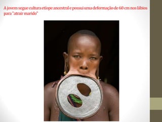 Ajovemsegueculturaetíopeancestralepossuiumadeformaçãode60cmnoslábios
para"atrairmarido"
 