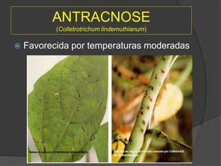 ANTRACNOSE
(Colletrotrichum lindemuthianum)
 Favorecida por temperaturas moderadas
 