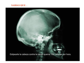 Golpearte la cabeza contra la pared quema 150 calorías por hora.  