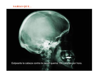 Golpearte la cabeza contra la pared quema 150 calorías por hora.  