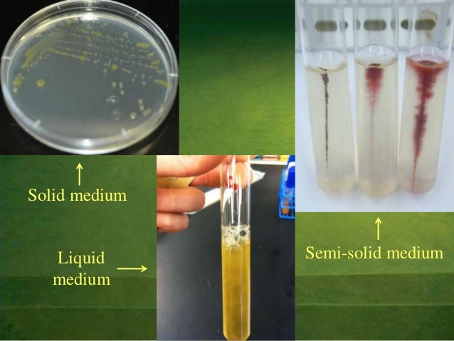 Bacteria Culture - MedNotes Blog