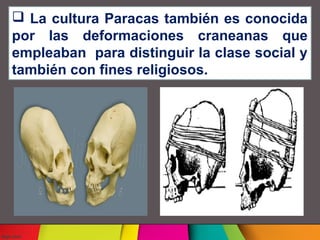  La cultura Paracas también es conocida
por las deformaciones craneanas que
empleaban para distinguir la clase social y
también con fines religiosos.