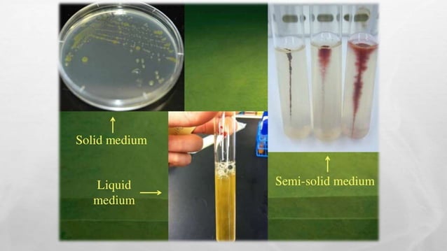 types of culture media | PPTX