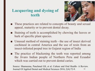 Lacquering and dyeing of
teeth
■ These practices are related to concepts of beauty and sexual
appeal, maturity or to prevent dental decay.
■ Staining of teeth is accomplished by chewing the leaves or
bark of specific plant species.
■ Unusual method of staining teeth - the use of insect derived
cochineal in central America and the use of resin from an
insect-infested peepul tree in Gujarat region of India
■ The practice of blackening the teeth was reported among
the Jivaro Indian people of Northern Peru and Ecuador
which was carried out to prevent dental caries.
69
Source: Shameema, Panchmal GS, et al. Culture and Oral Health- A Review.
Journal Of Applied Dental and Medical Sciences 2016; 2(4):72-9.
 