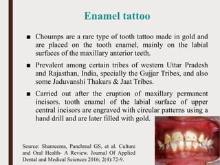 Enamel tattoo
■ Choumps are a rare type of tooth tattoo made in gold and
are placed on the tooth enamel, mainly on the labial
surfaces of the maxillary anterior teeth.
■ Prevalent among certain tribes of western Uttar Pradesh
and Rajasthan, India, specially the Gujjar Tribes, and also
some Jaduvanshi Thakurs & Jaat Tribes.
■ Carried out after the eruption of maxillary permanent
incisors. tooth enamel of the labial surface of upper
central incisors are engraved with circular patterns using a
hand drill and are later filled with gold.
75
Source: Shameema, Panchmal GS, et al. Culture
and Oral Health- A Review. Journal Of Applied
Dental and Medical Sciences 2016; 2(4):72-9.
 