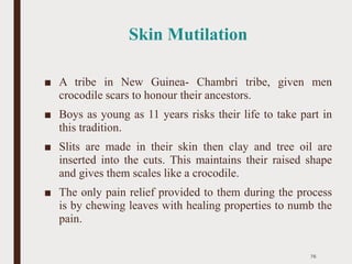 Skin Mutilation
■ A tribe in New Guinea- Chambri tribe, given men
crocodile scars to honour their ancestors.
■ Boys as young as 11 years risks their life to take part in
this tradition.
■ Slits are made in their skin then clay and tree oil are
inserted into the cuts. This maintains their raised shape
and gives them scales like a crocodile.
■ The only pain relief provided to them during the process
is by chewing leaves with healing properties to numb the
pain.
76
 