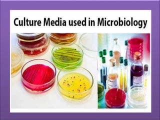 CULTURE MEDIA
USED
IN MICROBIOLOGY
 
